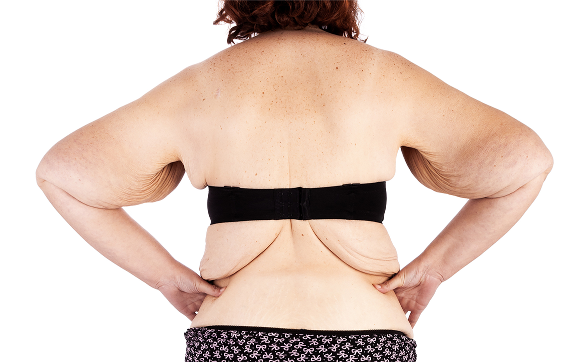 Woman Weight Loss